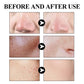 West & Month Blackhead Mud Mask Pore Care