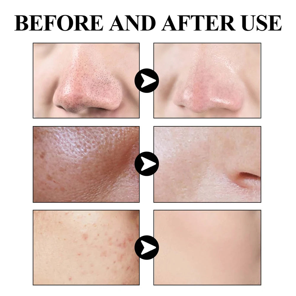 West & Month Blackhead Mud Mask Pore Care