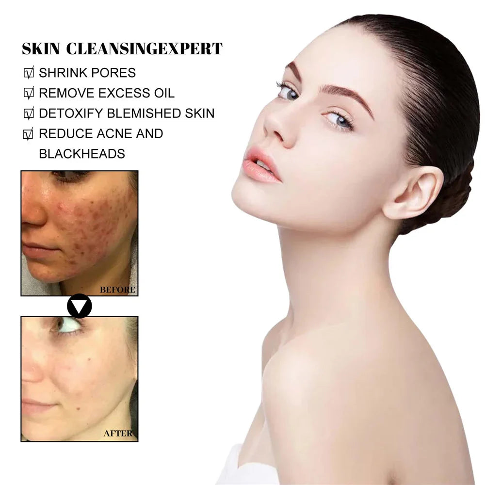 West & Month Blackhead Mud Mask Pore Care