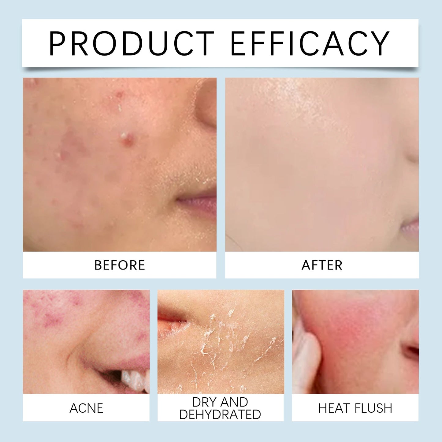 Hyaluronic Acid Face Serum Hydrating Radiance Skin Care