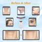 Anti Wrinkle Facial Massager Beauty Skin Care Device Tool